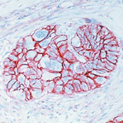 CD44 Antibody in Immunohistochemistry (Paraffin) (IHC (P))