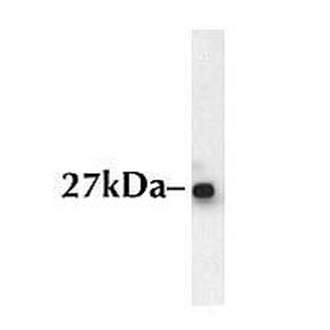 Bcl-X Antibody in Western Blot (WB)