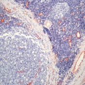 VWF Antibody in Immunohistochemistry (Paraffin) (IHC (P))