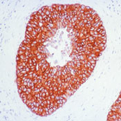 ErbB2 (HER-2) Antibody in Immunohistochemistry (Paraffin) (IHC (P))