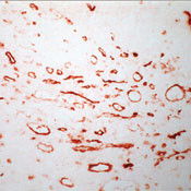 CD36 Antibody in Immunohistochemistry (Frozen) (IHC (F))