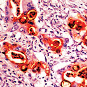 CA19-9 Antibody in Immunohistochemistry (IHC)