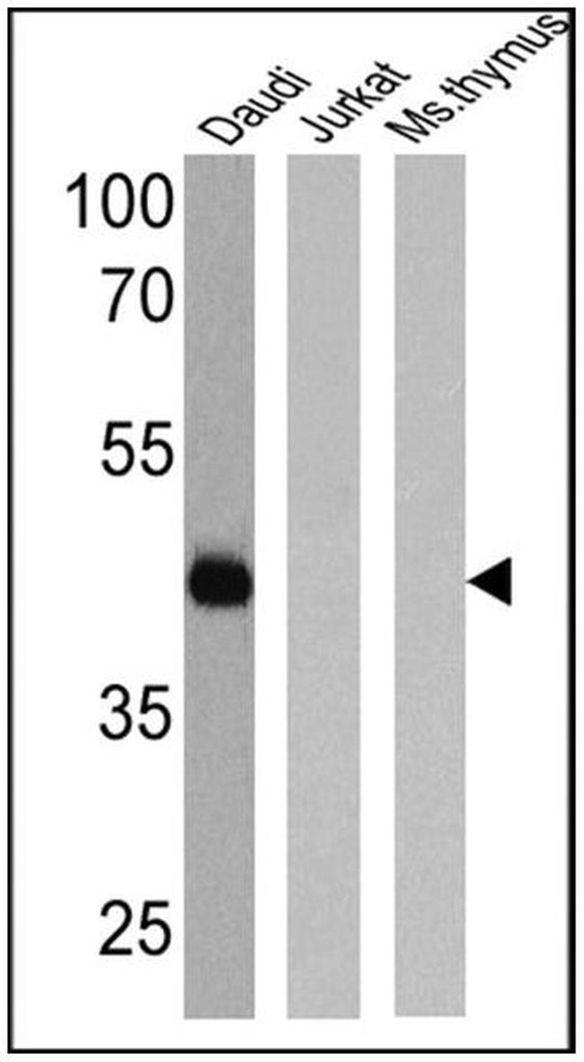 CD38 Antibody in Western Blot (WB)