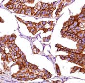 beta Catenin Antibody in Immunohistochemistry (Paraffin) (IHC (P))