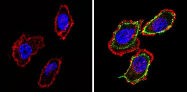 PSA Antibody in Immunocytochemistry (ICC/IF)