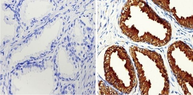 PSA Antibody in Immunohistochemistry (Paraffin) (IHC (P))