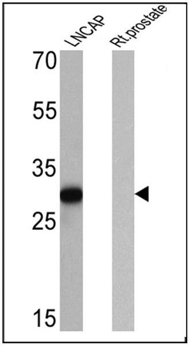 PSA Antibody in Western Blot (WB)