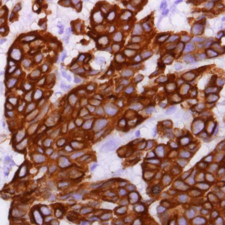 Cytokeratin 8 Antibody in Immunohistochemistry (Paraffin) (IHC (P))