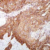 Phospho-EGFR (Tyr1068) Antibody in Immunohistochemistry (Paraffin) (IHC (P))