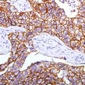 ErbB2 (HER-2) Antibody in Immunohistochemistry (Paraffin) (IHC (P))