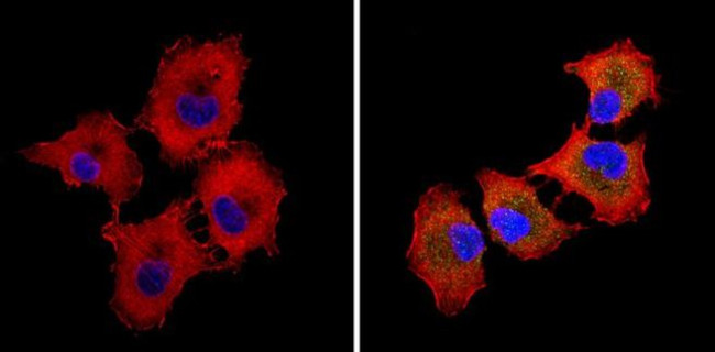 ALK Antibody in Immunocytochemistry (ICC/IF)