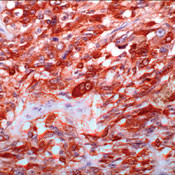 Calcitonin Antibody in Immunohistochemistry (Paraffin) (IHC (P))