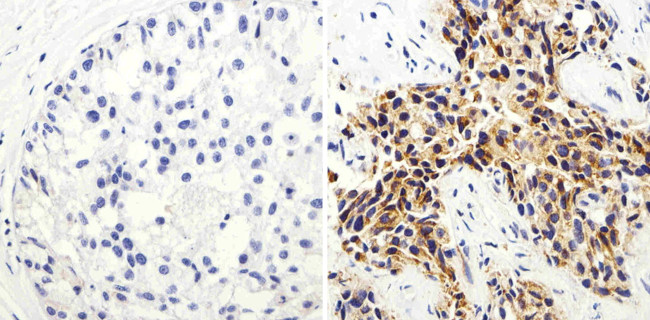 COX2 Antibody in Immunohistochemistry (Paraffin) (IHC (P))