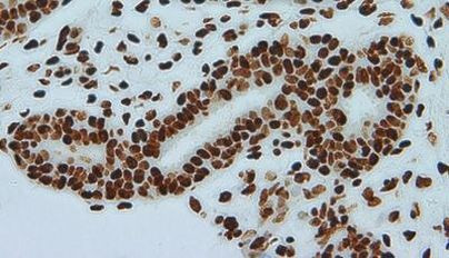 TBP Antibody in Immunohistochemistry (IHC)