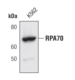 RPA70 Antibody in Western Blot (WB)