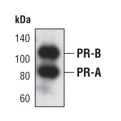 Progesterone Receptor Antibody in Western Blot (WB)