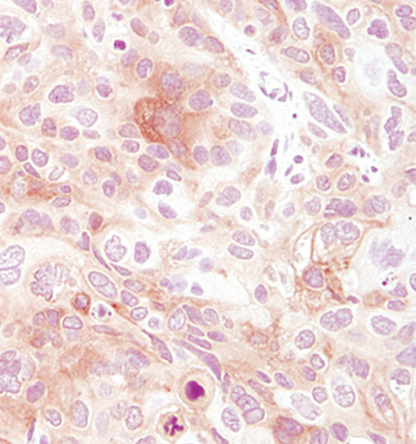 FGFR3 Antibody in Immunohistochemistry (Paraffin) (IHC (P))