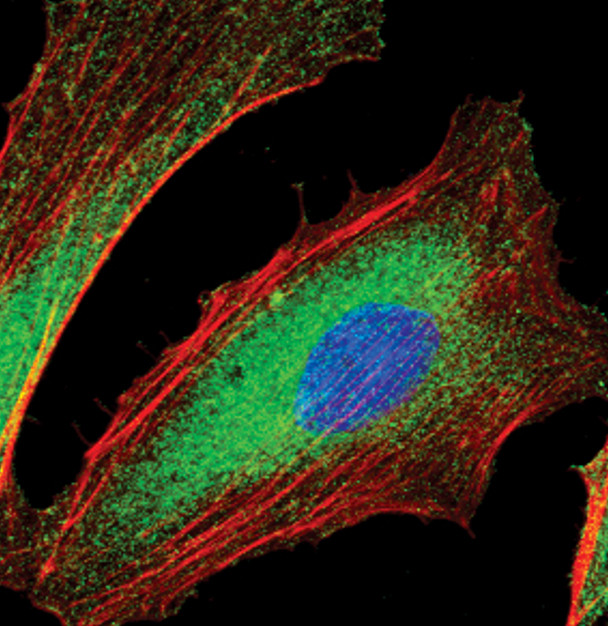 SHIP2 Antibody in Immunocytochemistry (ICC/IF)