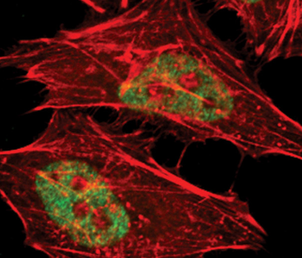 GCN5 Antibody in Immunocytochemistry (ICC/IF)