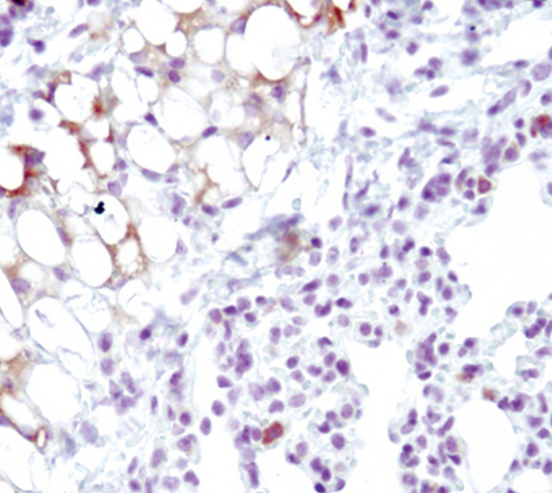 SCD Antibody in Immunohistochemistry (Paraffin) (IHC (P))