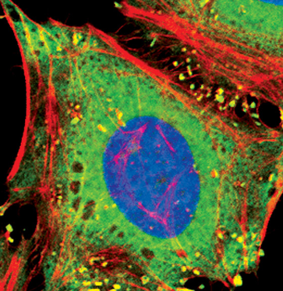 PKM2 Antibody in Immunocytochemistry (ICC/IF)