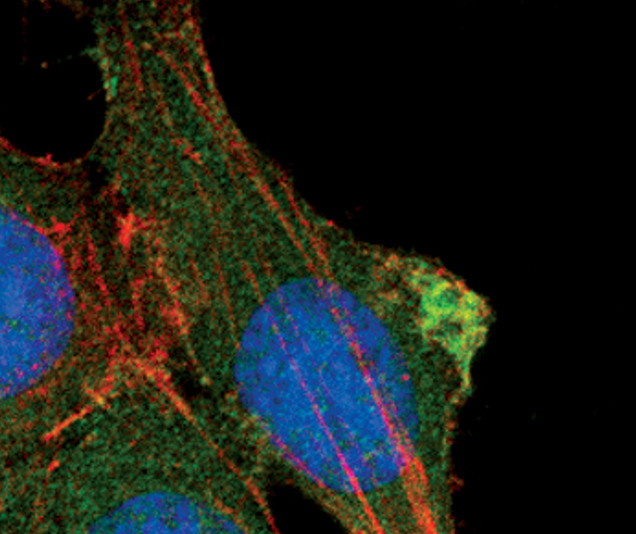 AKT Pan Antibody in Immunocytochemistry (ICC/IF)