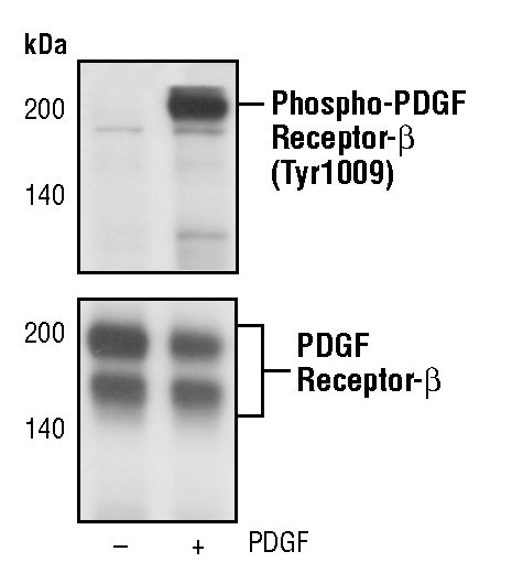 Phospho-PDGFRB (Tyr1009) Antibody in Western Blot (WB)