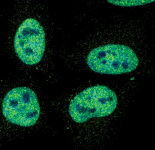 Phospho-STAT1 (Tyr701) Antibody in Immunocytochemistry (ICC/IF)