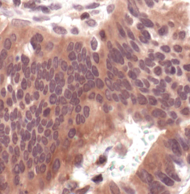 MEK1/MEK2 Antibody in Immunohistochemistry (Paraffin) (IHC (P))