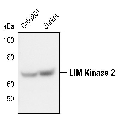 LIMK2 Antibody in Western Blot (WB)