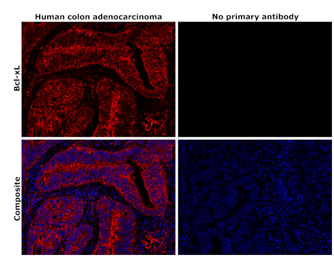 Bcl-xL Antibody in Immunohistochemistry (Paraffin) (IHC (P))