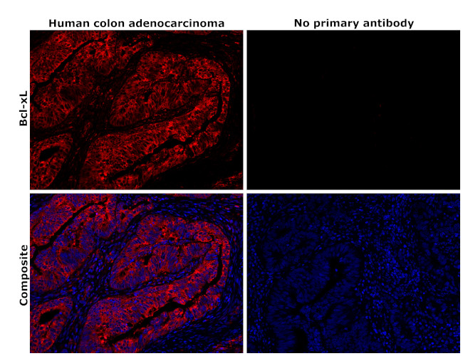 Bcl-xL Antibody in Immunohistochemistry (Paraffin) (IHC (P))