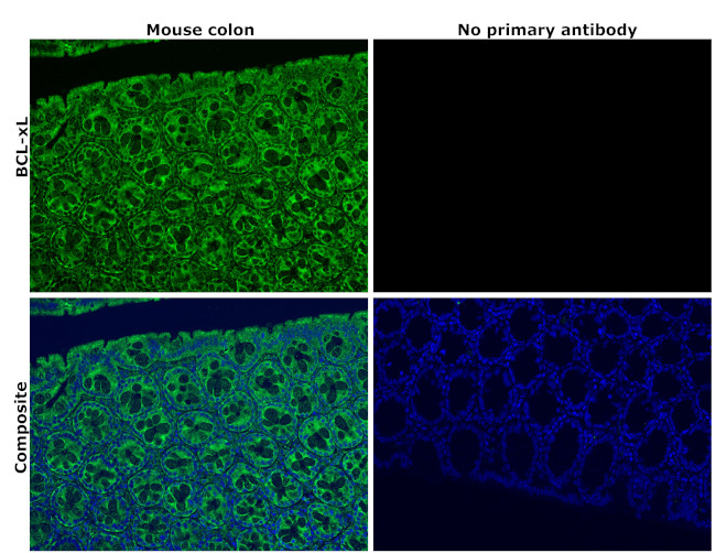 Bcl-xL Antibody in Immunohistochemistry (Paraffin) (IHC (P))