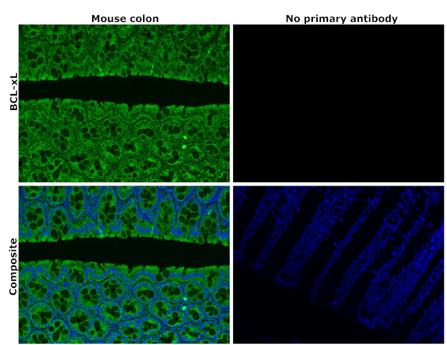 Bcl-xL Antibody in Immunohistochemistry (Paraffin) (IHC (P))