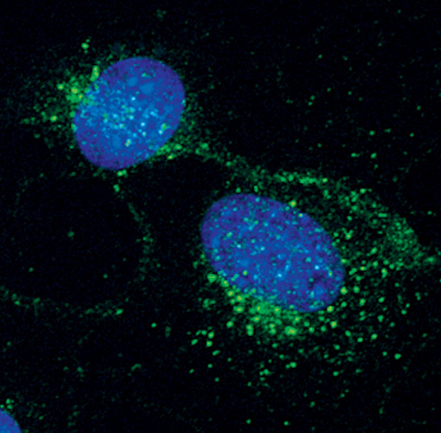 PDGFRB Antibody in Immunocytochemistry (ICC/IF)