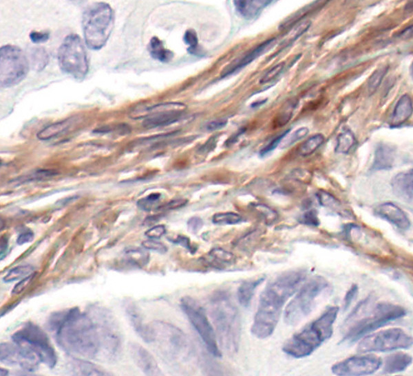 PDGFRB Antibody in Immunohistochemistry (Paraffin) (IHC (P))