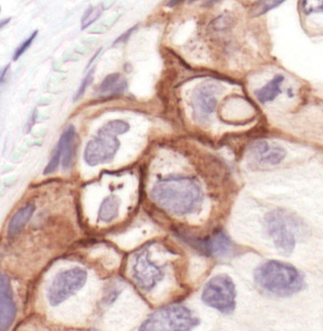 Phospho-EGFR (Tyr1173) Antibody in Immunohistochemistry (Paraffin) (IHC (P))