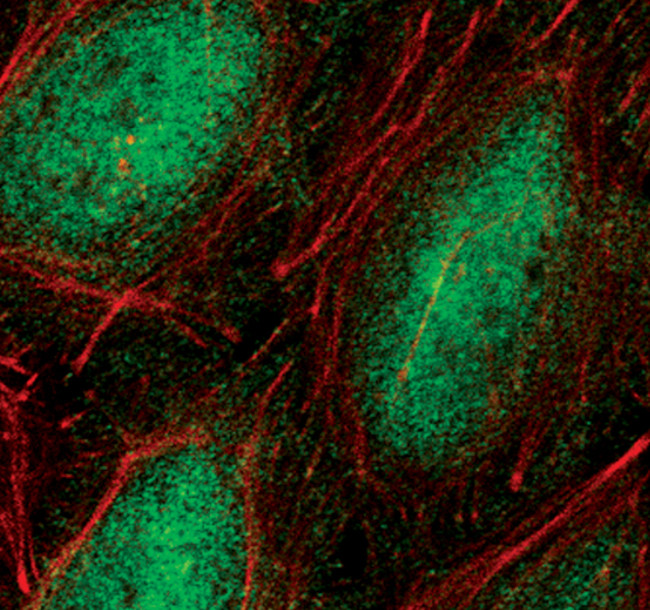 Phospho-NFkB P65 (Ser536) Monoclonal Antibody (T.849.2) (MA5-15160)