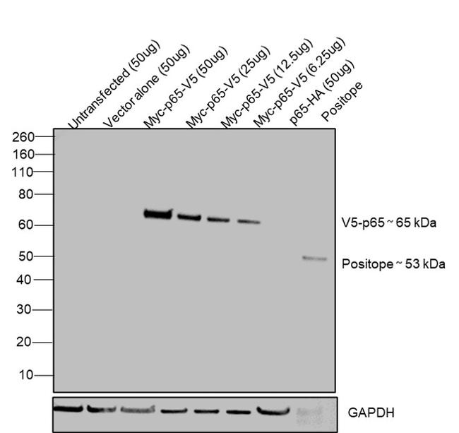 Western blots show p65 antibodies that passed the test of specificity