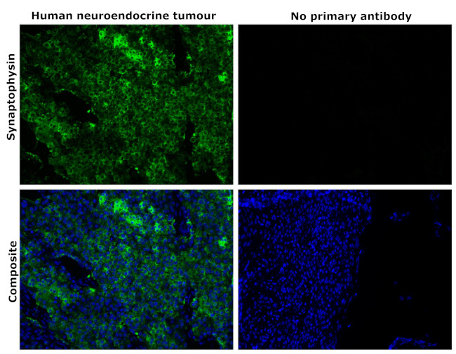 Synaptophysin Antibody in Immunohistochemistry (Paraffin) (IHC (P))