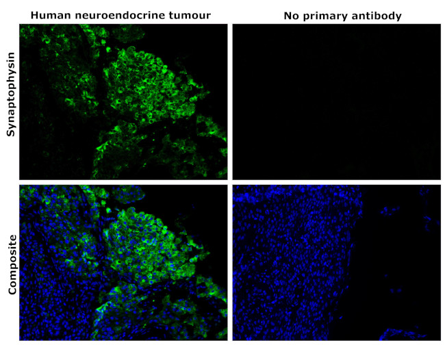 Synaptophysin Antibody in Immunohistochemistry (Paraffin) (IHC (P))