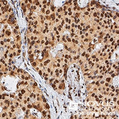 TERT Antibody in Immunohistochemistry (Paraffin) (IHC (P))