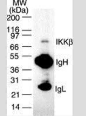 IKK beta Antibody in Immunoprecipitation (IP)