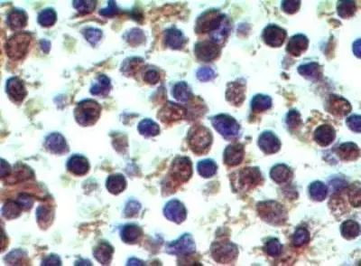 Dectin 2 Antibody in Immunohistochemistry (Paraffin) (IHC (P))