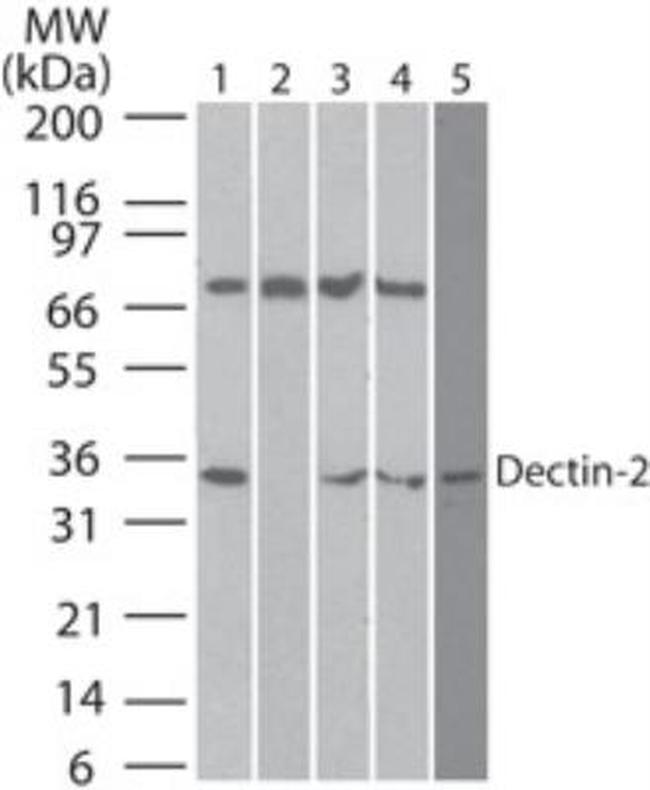 Dectin 2 Antibody in Western Blot (WB)