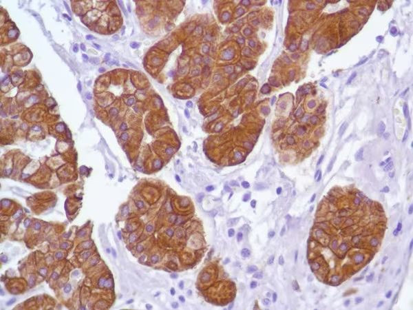 Cytokeratin 18 Antibody in Immunohistochemistry (Paraffin) (IHC (P))