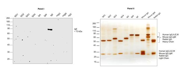 Human IgE Secondary Antibody in Western Blot (WB)