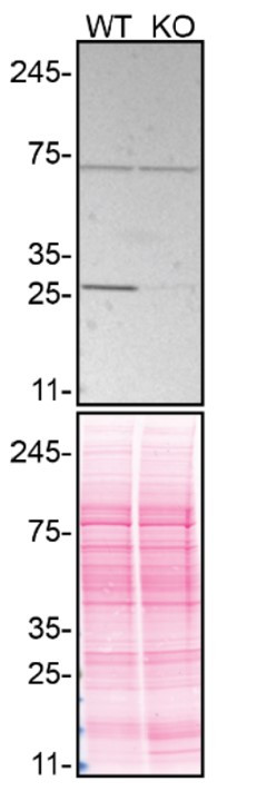 RhoGDI Antibody