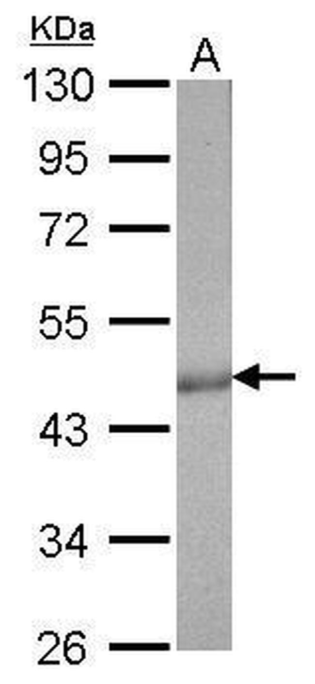 Citrate Synthase Antibody in Western Blot (WB)