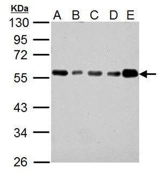 IP6K1 Antibody in Western Blot (WB)